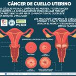CÁNCER DE CUELLO UTERINO - PORTADA