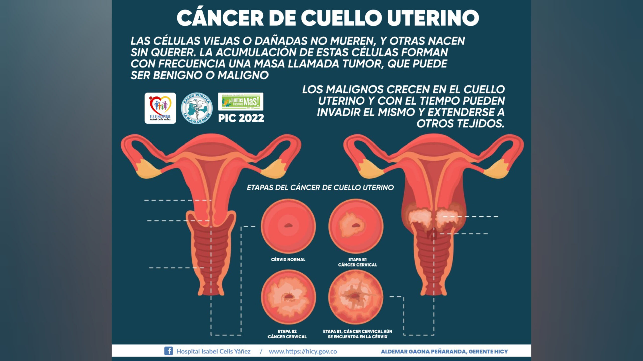CÁNCER DE CUELLO UTERINO - PORTADA
